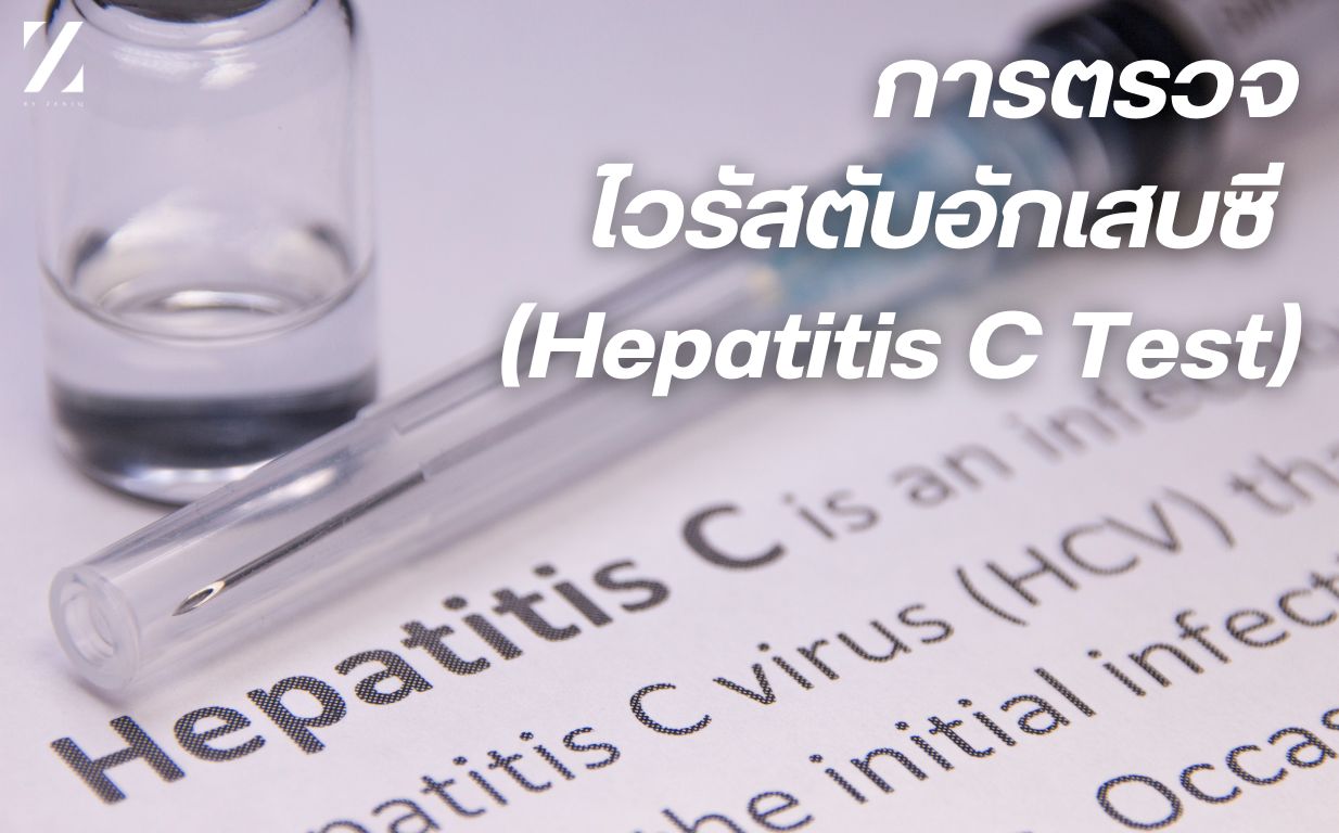 ตรวจหา HEpatitis C