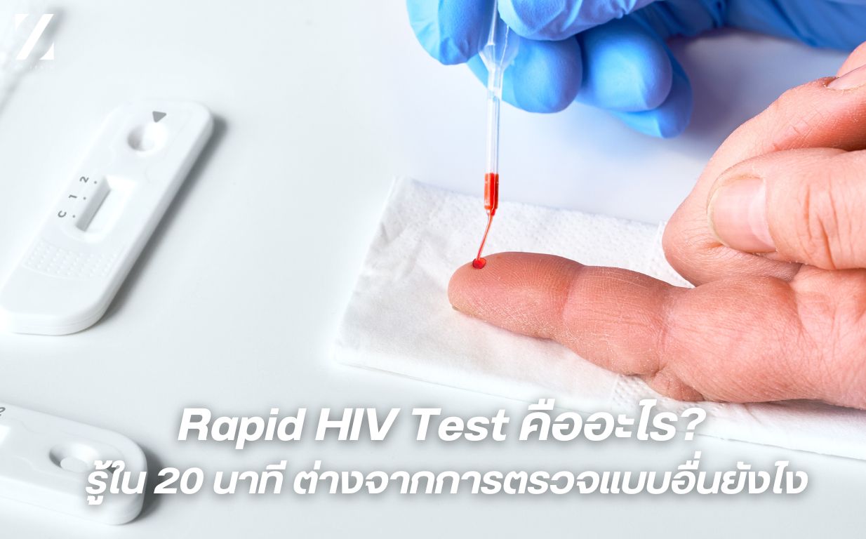 Rapid HIV Test คืออะไร